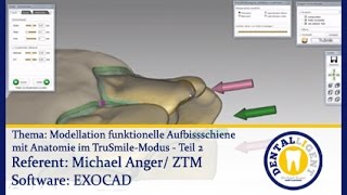 Dentaltechnik CADCAMTeaser  Model funkt Aufbißschiene mit Anatomie im TruSmileModus  Teil 2 [upl. by Atiuqihs868]