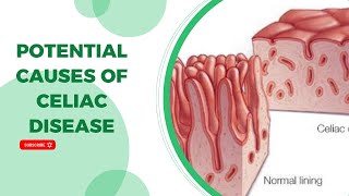 Potential Causes of Celiac Disease [upl. by Foster]