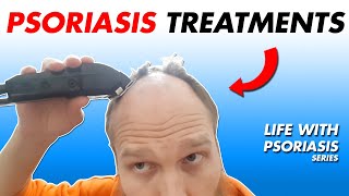 5 Psoriasis Treatments Bonus  Watch Till The End  Life With Psoriasis [upl. by Zurkow201]