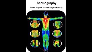 Dr Philip Getson Thermographic Diagnostic Imaging [upl. by Derte838]