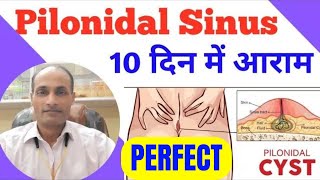 What is Pilonydal Sinus  Best Homeopathic Medicine for Pilonidal Cyst  Pilonidal Sinus Treatment [upl. by Mahmud]