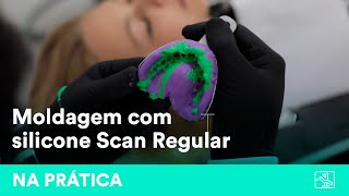 Moldagem com silicones de adição Scan Regular  por drs Voss amp Rosa [upl. by Neelcaj]