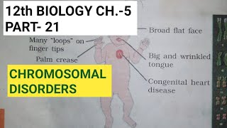 Class 12 biology chapter 5part 21chromosomal disordersby study with Farru [upl. by Thurmond]