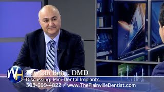 Replacing Missing Teeth with MiniDental Implants with Plainville MA dentist Dr Peyman Beigi [upl. by Egarton]