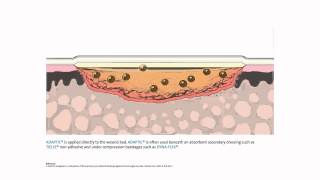 ADAPTIC™ NonAdhering Dressing  Mode of action [upl. by Aridaj]