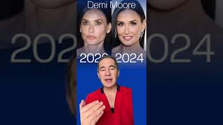 MAGNÍFICO EL CAMBIO DE DEMI MOORE  CELEBRIDAD CON PROCEDIMIENTO FACIAL  drjorgespinosa [upl. by Kinsley]