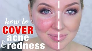 How to Cover Acne amp Redness  DRUGSTORE Makeup [upl. by Llehsal53]