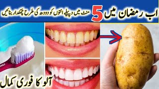 5 Natural Ways to Remove Tartar Buildup  teeth cleaning before and after [upl. by Assetak747]