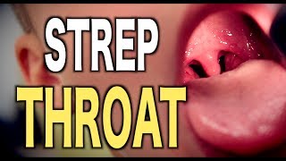 Strep Throat LIVE DIAGNOSIS [upl. by Loella772]