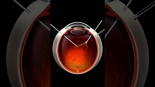 How is vitrectomy done Vitrectomy can change your life if you have diabetic retinopathy [upl. by Darmit]