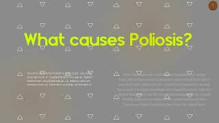 What causes Poliosis Is Poliosis a disease [upl. by Alya]