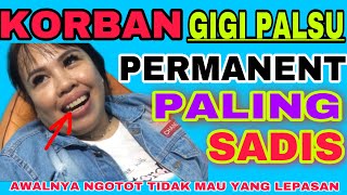 Menyesal pakai gigi palsu permanent setelah tau hasil gigi palsu lepasan [upl. by Alleunamme]