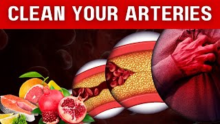 These Foods Unclog Arteries amp Can Prevent A Heart Attack [upl. by Alenson200]