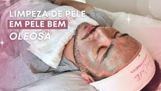 Limpeza de Pele Profissional em Pele Muito Oleosa [upl. by Lindell]