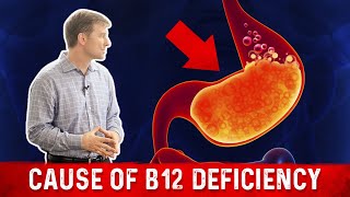 Vitamin B12 Deficiency The most common Cause – Dr Berg [upl. by Avehsile]