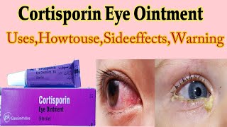 Cortisporin Eye Ointment  Cortisporin Eye Ointment Uses in detail [upl. by Janeczka470]