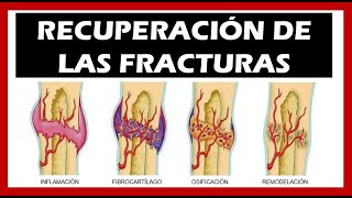 Consolidación de las Fracturas 🦴 Tiempo Fases [upl. by Gnov]