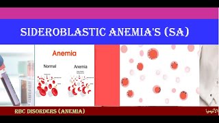 Lecture 17 Sideroblastic Anemia  SA [upl. by Denman7]