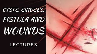 CYSTS SINUSES FISTULA WOUNDS lecture 1 DERMOID and SEBACEOUS CYSTS easy explanation [upl. by Yee252]