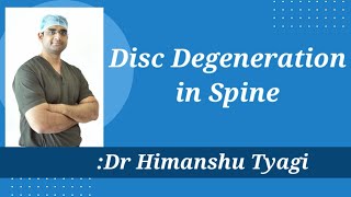 Disc Degeneration in spine [upl. by Nwahsan]