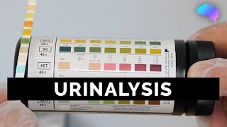 Urinalysis  OSCE Guide old version  UKMLA  CPSA [upl. by Adian]