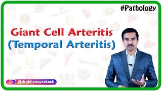 Giant cell arteritis Temporal arteritis Vasculitis Pathology  Usmle Step 1 [upl. by Gross576]