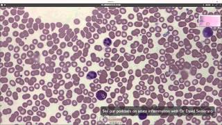 What blood looks like down the microscope [upl. by Kerad202]