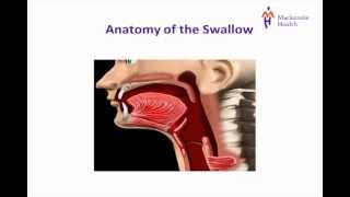 Stroke Education  Dysphagia [upl. by Irv]