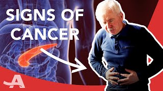 Early Signs of Pancreatic Cancer [upl. by Rednav]