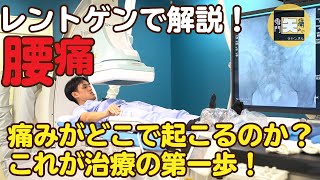 ★医師が解説★【腰痛】レントゲンを使って、腰痛の原因部位を解説します！ [upl. by Aitekram]