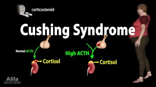 Cushing Syndrome Animation [upl. by Eliathan]