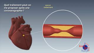 coronarographie [upl. by Nnanerak346]