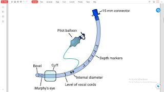 tracheal tube [upl. by Karolyn]