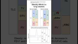 Obesity effects on lung volumes [upl. by Areehs]