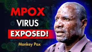 New PANDEMIC is Spreading Across The World Monkey Pox Virus Explained [upl. by Asena99]