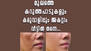 How to remove black spots and melasmakarimangalyam from face and its cause [upl. by Ydnyc]