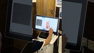 Dental Scan Demo on Model [upl. by Bahe318]