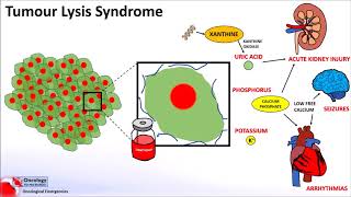 Tumour Lysis Syndrome [upl. by Koloski]