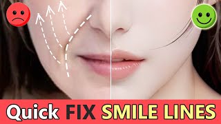 Quick Remove Smile lines Nasolabial Fold Lift Saggy Cheeks Fill Cheek lines  Face Rejuvenation [upl. by Aicssej830]