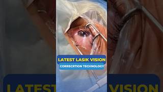 Latest Lasik Vision Correction Technology [upl. by Duwalt331]