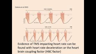 OHBM 2024  Symposium  John Coetzee  HeartBrain Coupling Factor as a Correlate of iTBS Target … [upl. by Eidde]