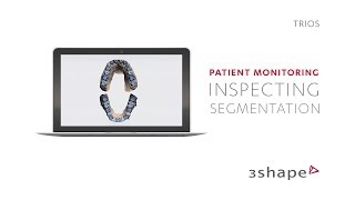 3Shape TRIOS  Inspecting and Editing Segmentation – 3Shape TRIOS Patient Monitoring [upl. by Alberic281]