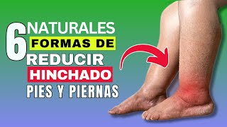 6 Maneras Naturales De Reducir Los Pies Y Tobillos Hinchados ¡RÁPIDAMENTE [upl. by Baugh]