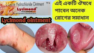 Lycimond ointment  Lycimond ointment in Bengali review  benefits usesMrpsideeffects [upl. by Neerroc570]