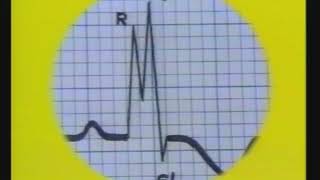 2 Introduction amp PQRST Terminology  ECG Reading  Dr Vaidya [upl. by Tamanaha]