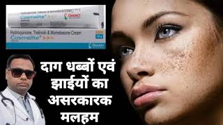 Ointment for melasma। Cosmelite ointment review Hydroquinone Tretinoin amp Mometasone cream। uses। [upl. by Dyer]