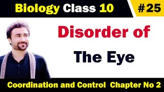 Disorder of eye class 10 biology  short sightedness and long sightedness explained in urdu [upl. by Hi]