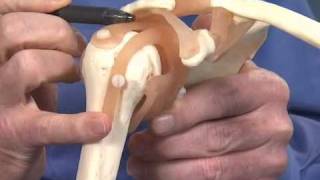 Shoulder Impingement  Dr Richard Hawkins [upl. by Trixi]