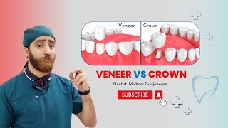 Veneer vs Crown  which is best for teeth  Doctor Gudjohnsen [upl. by Ban178]