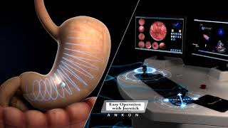 Capsule Endoscopy Animation  ANKON NaviCam [upl. by Armin]